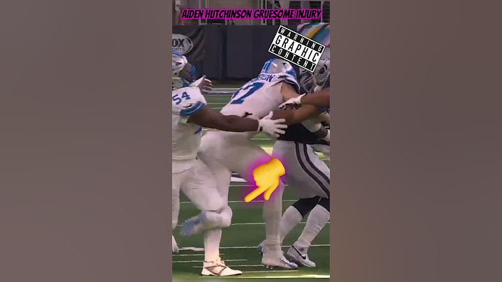 ⚠️GRAPHIC VIDEO⚠️ Detroit Lions DE Aiden Hutchinson Horrific Injury #nfl #nflnews #detroitlions