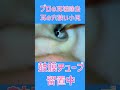 【耳そうじ】小児チューブ留置中 #earcleaning