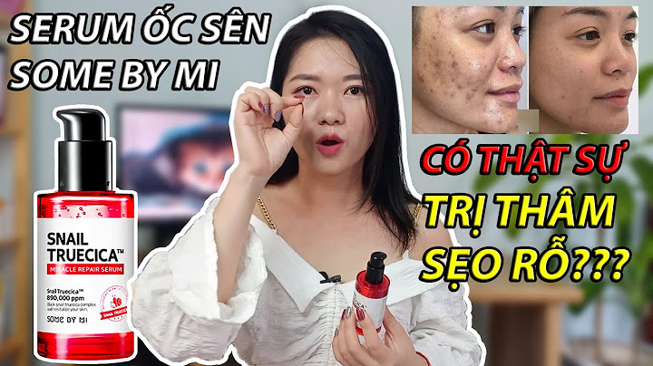 Review some by mi ốc sên năm 2024