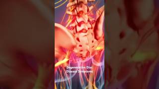 Degenerative Disc Disease Symptoms