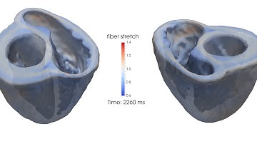 Image-Based Modeling and Simulation of the Human Heart using High-Performance Computing