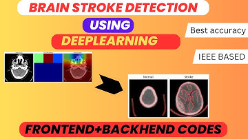 Brain Stroke Detection Using Deep Learning | Best IEEE-Based Project with Web App 2025-26