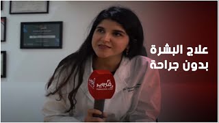 ياسمين السليماني.. تكشف لـفبراير أحدث التقنيات لعلاج مشاكل البشرة دون عمليات التجميل