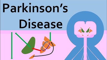 Parkinson