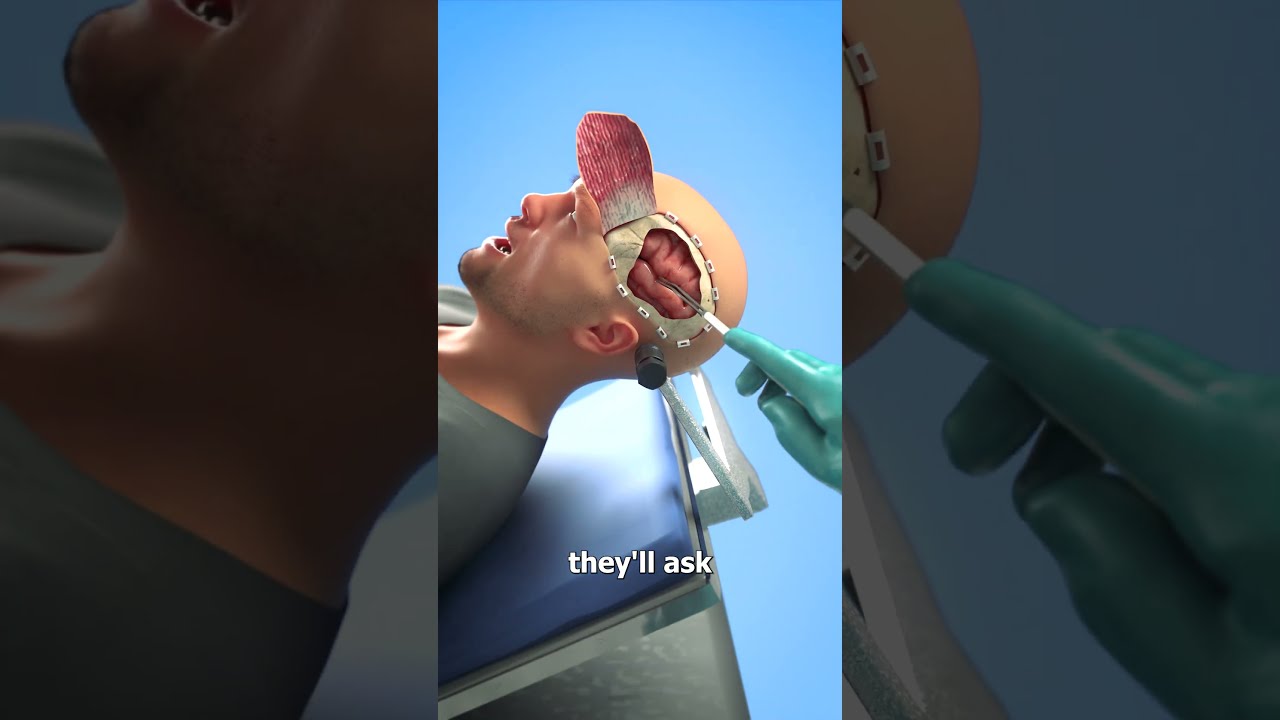 Why Brain Surgeries Are Done While Awake 😨