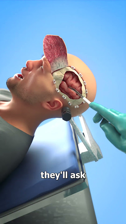 Why Brain Surgeries Are Done While Awake 😨