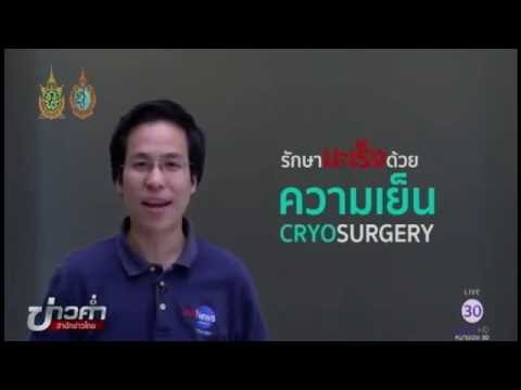 ชัวร์ก่อนแชร์ : ความเย็น รักษามะเร็งได้จริงหรือ?