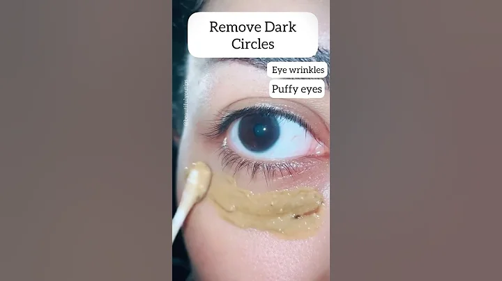 😳3 Nights Remove Dark Circles/Eye Wrinkles/puffy eyes| Young Eyes #darkcircles #skincare #shorts - DayDayNews