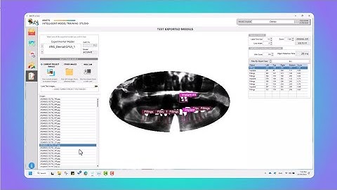 Mastering Custom Object Detection: Training Models with ANSTS (Step-by-Step Guide)