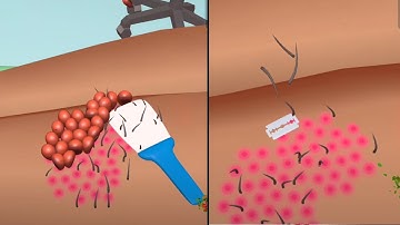 Parasite Cleaner: in New Levels Gameplay iOS,Android Update Trailer Walkthrough Mobile Game KSMXQ13