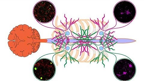 Mutation in senataxin alters the mechanism of R-loop resolution in amyotrophic lateral sclerosis 4