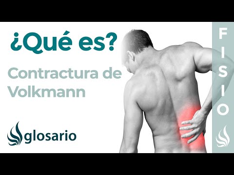 CONTRACTURA de VOLKMANN | Qué es, qué estructuras afecta, síntomas, signos, causas y tratamiento