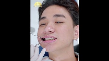 ⭐ 5 tháng thoát răng khấp khểnh của 9X Hà Thành