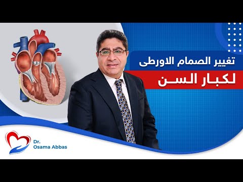 عملية تغيير الصمام الأورطي بالتدخل المحدود والمنظار لكبار السن دكتور اسامة عباس