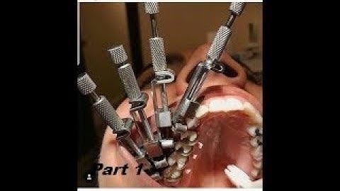 🦷Matrix Band and Tofflemire Assembly PART I