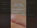 Pre-Birth Acupuncture