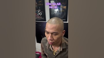 Xăm tóc sau 1 năm #reviewxămtóc  xăm tóc hàng đầu thế giới  #smp #scalp