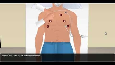 Tension Pneumothorax Simulation