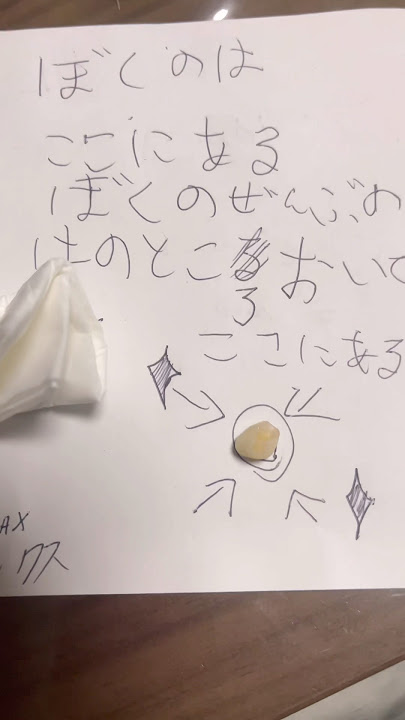 HETO DAW YUNG NGIPIN NYA NA NATANGGAL 😂😂😂