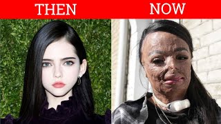 40 Celebrities Before and After Plastic Surgery😱
