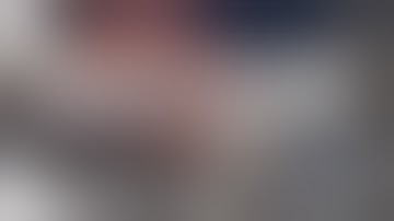 Lap  Vagas  Preserving Proximal Gastrectomy en bloc with splenectomy for locally advanced GIST