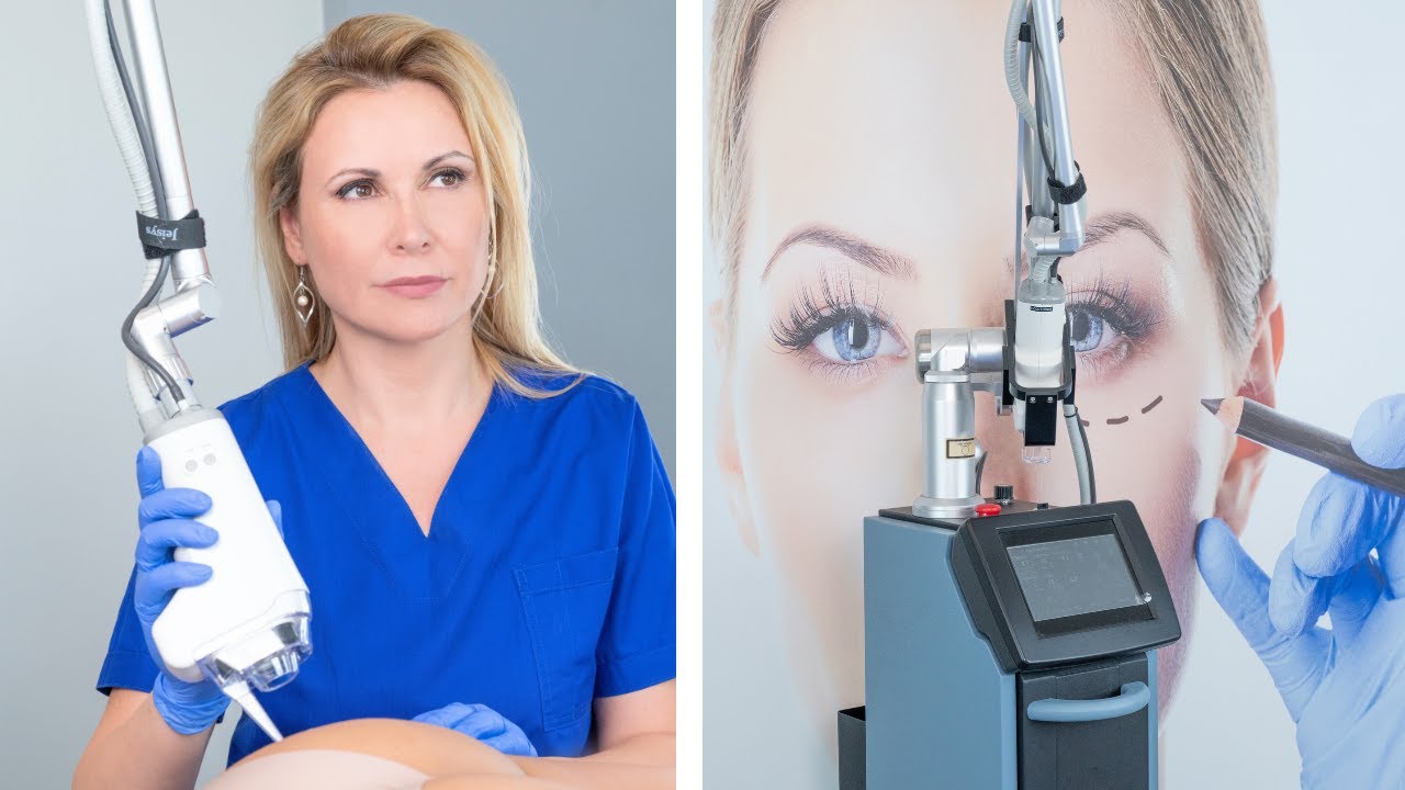 Fractional Laser Σώματος - Πως Γίνεται 