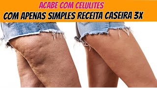 Melhore as Celulites com esta Simples Receita Caseira