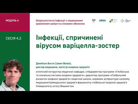 4.2 Інфекції, спричинені вірусом варіцелла-зостер