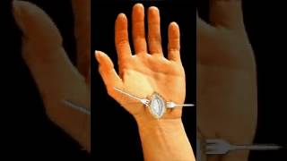 Intervento Al Tunnel Carpale