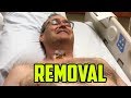 Drain Removal from My Neck!   MUST WATCH