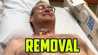 Drain Removal from My Neck!   MUST WATCH