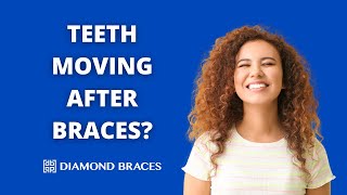 Can My Teeth Move Back After Braces?