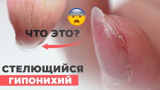 ГИПОНИХИЙ | Как сделать аппаратный маникюр и не поранить?