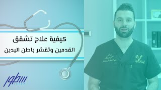 كيفية علاج تشقق القدمين وتشقر باطن اليدين