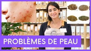 Solution Naturelle Contre Lacné, Eczéma, Psoriasis, Problèmes De Peau, Boutons, Dermite ...