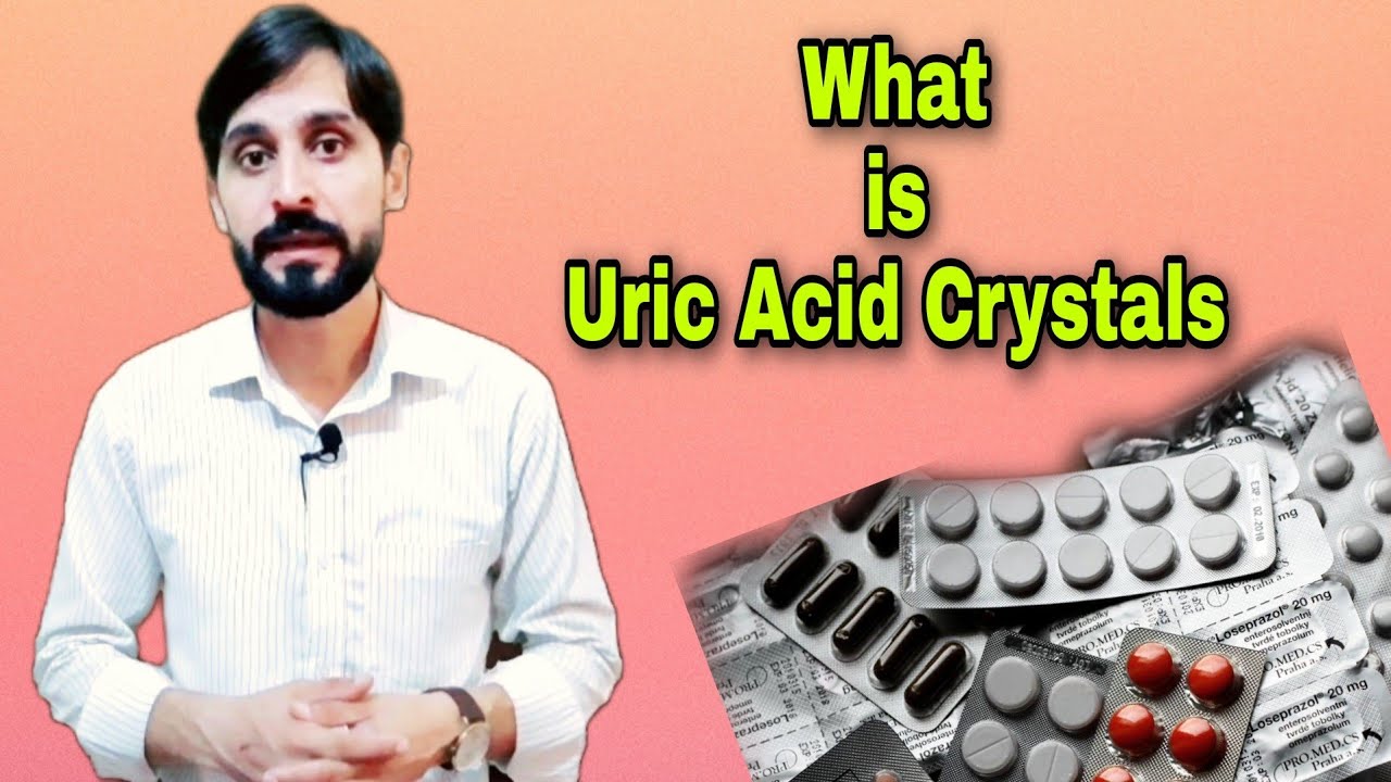 Uric Acid Crystals in Urine What is Uric Acid Crystals Uric Acid Stones Causes Treatment
