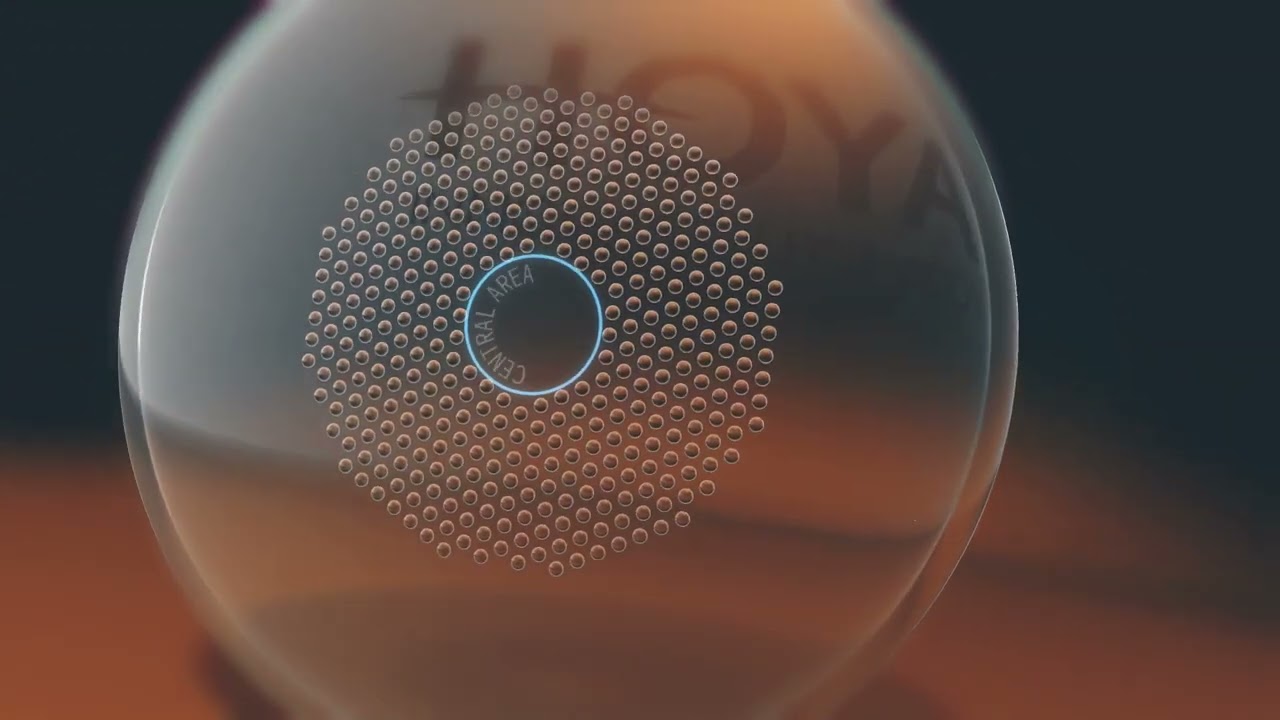 MiYOSMART Glasses | N. Ireland Myopia Management | Impressive 67% reduction in myopia progression