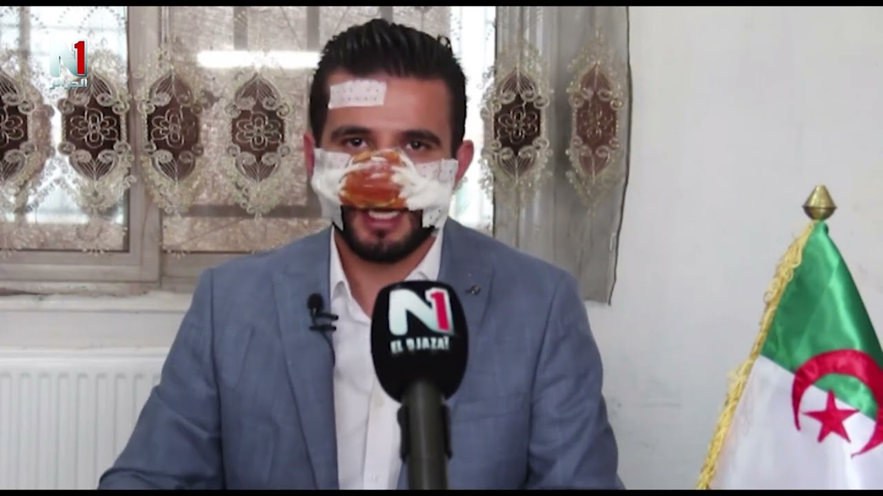 محاولة حرق و تحطيم محطة الخدمات في منتصف الليل بولاية أم البواقي