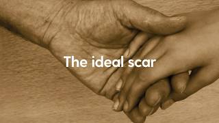 The Pulvertaft Hand Centre   Scar Management