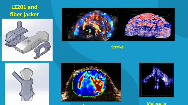 July 2016 Webinar: Exploring New Biomarkers in Hig...
