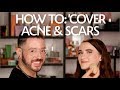 How To: Cover Acne & Scars | Sephora