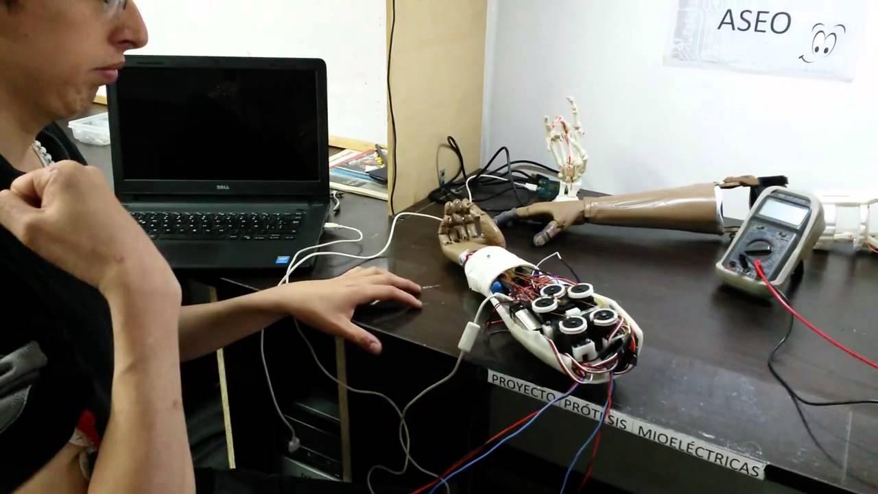 PROTESIS MIOELECTRICA