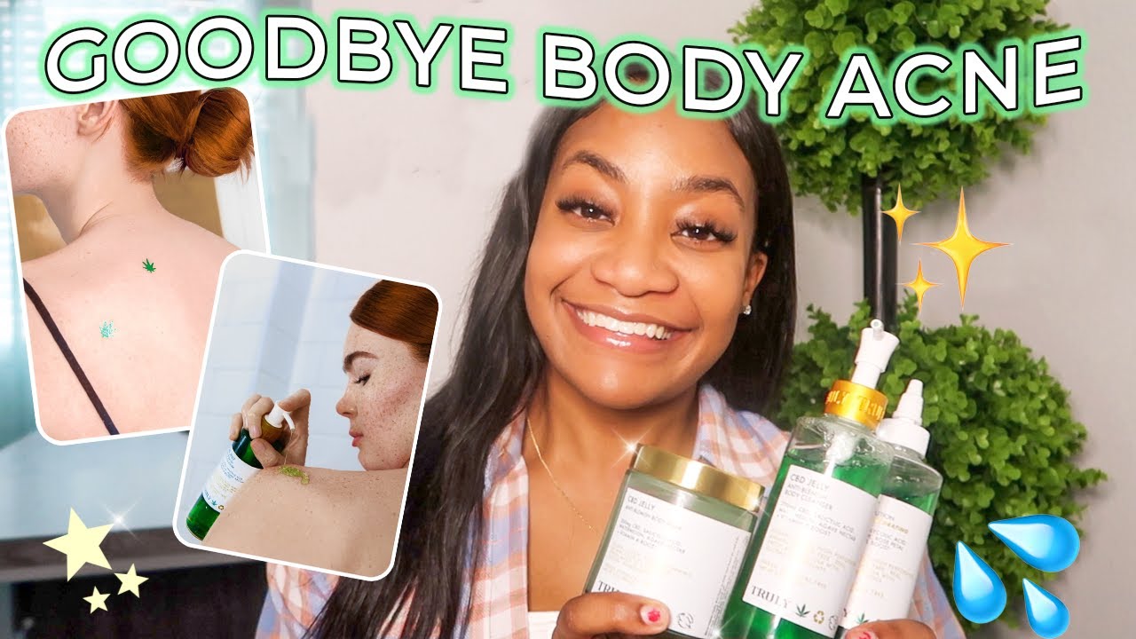 How I Cleared My Body Acne | Body Skincare Products That Changed My ...