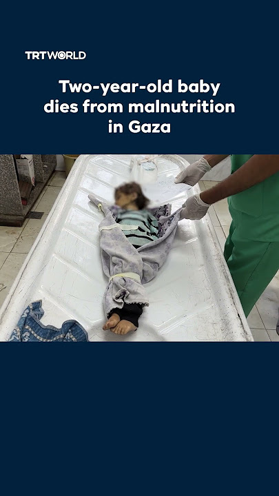 Two-year-old Palestinian baby dies of hunger in Gaza