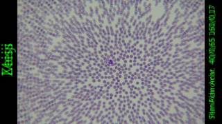 40x achromatic microscope objectives