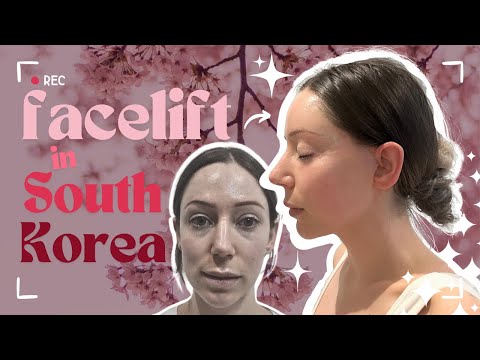 Why go to Korea for a Facelift? - 2024 id Model Rachel's Plastic Surgery Story