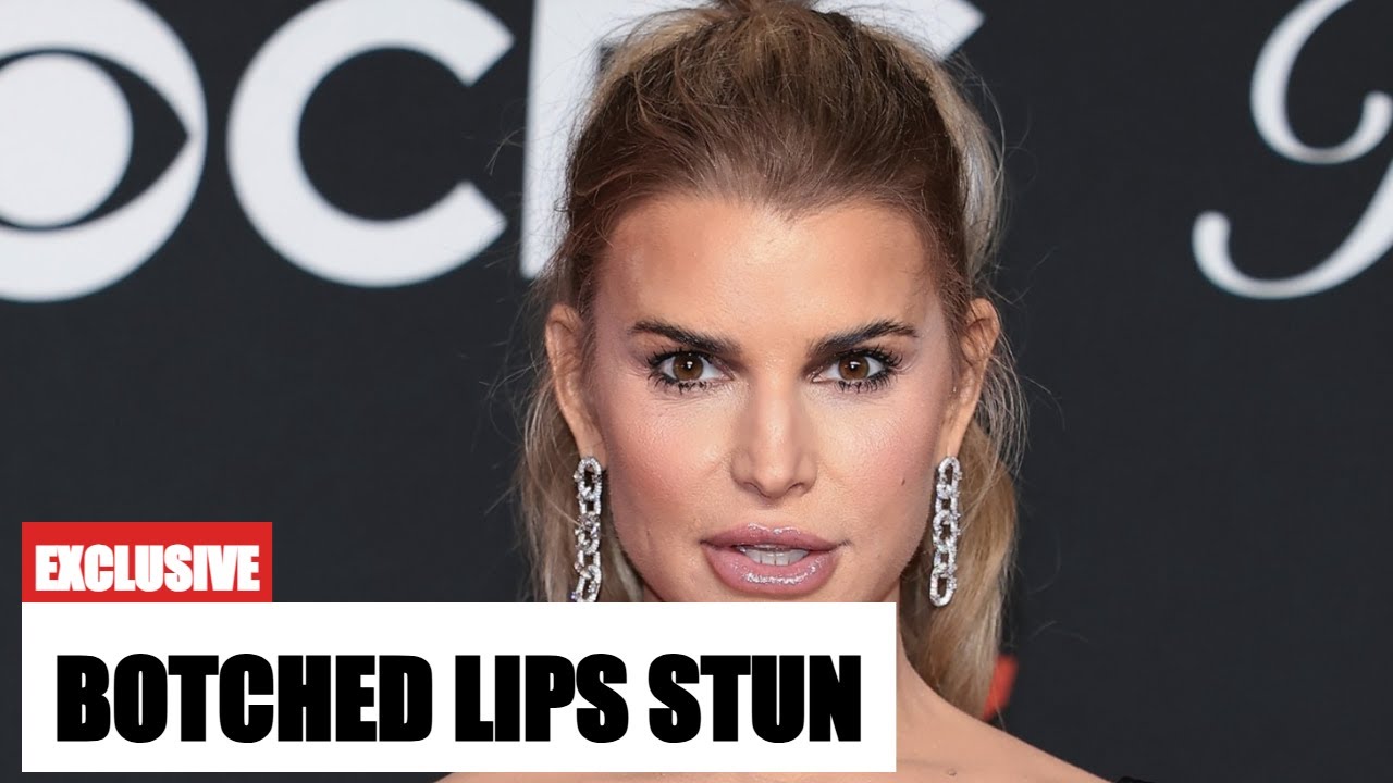 Jessica Simpson’s Botched Lip Injections STUN at 2025 VMAs! - YouTube