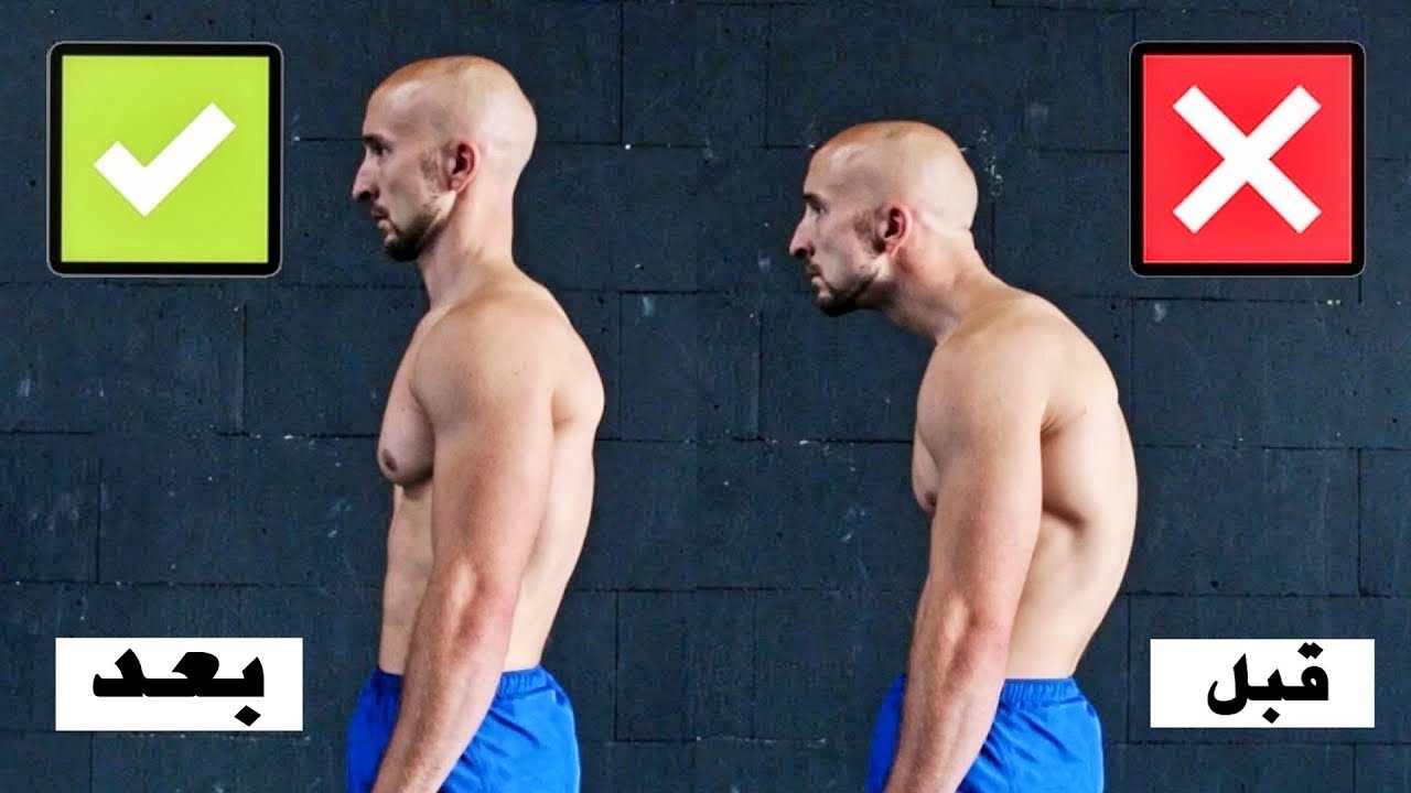 اسهل طريقة لعلاج تقوس الظهر [ تمارين معالجتها بالبيت بسهولة ] سر هنا ..