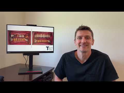 Case film: a business man's new, confident smile — Teuscher Legacy Dental