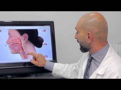 Trans-Oral Laser for the Treatment of Zenker’s Diverticulum | Dr. Babak Larian in Los Angeles